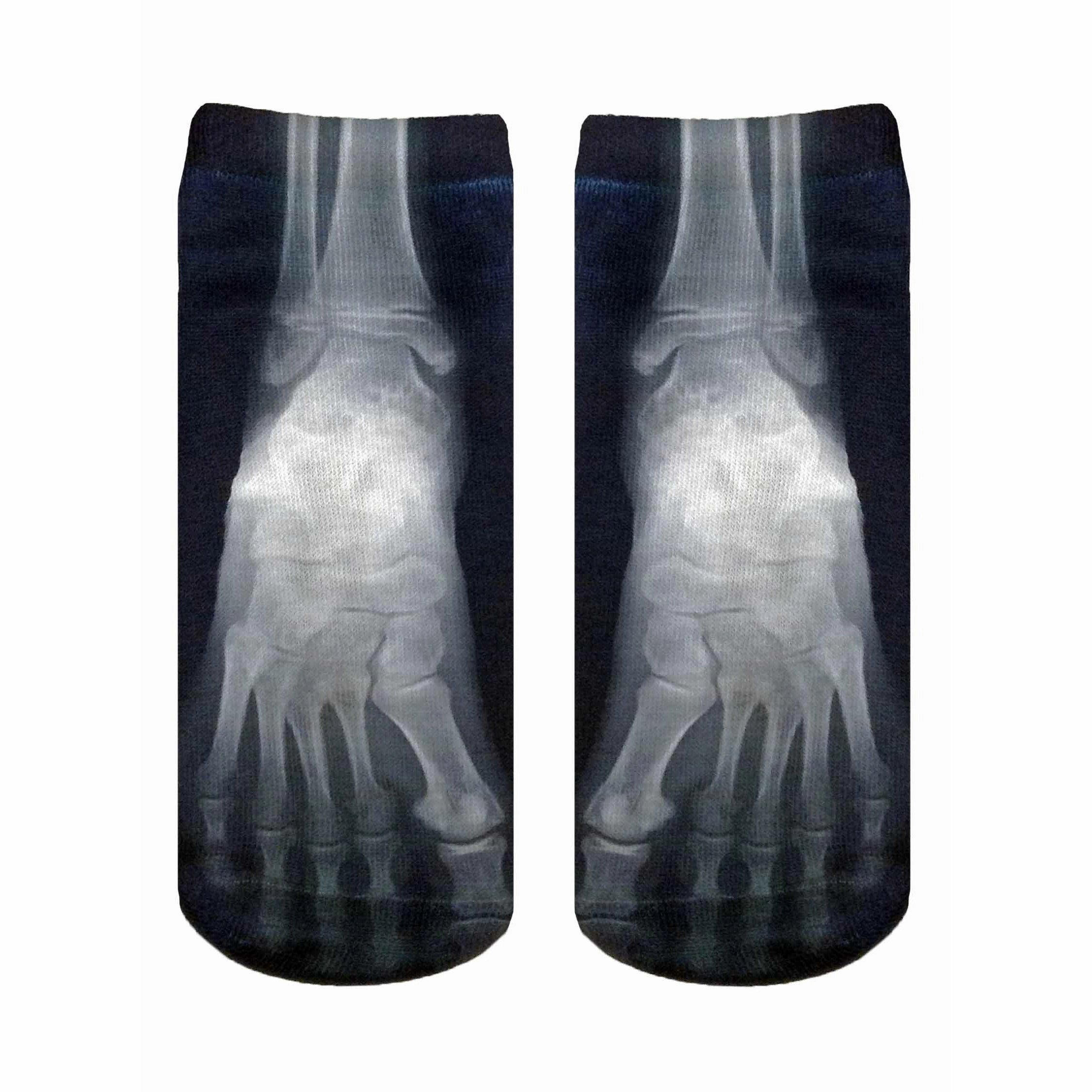 X-Ray