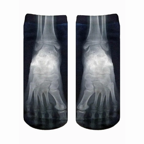 X-Ray